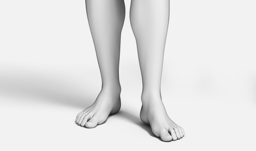 하지정맥류 수술 갑상선질환